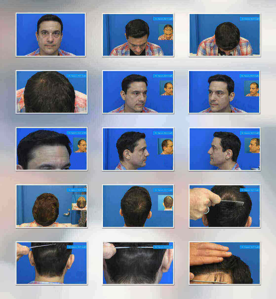 About Image