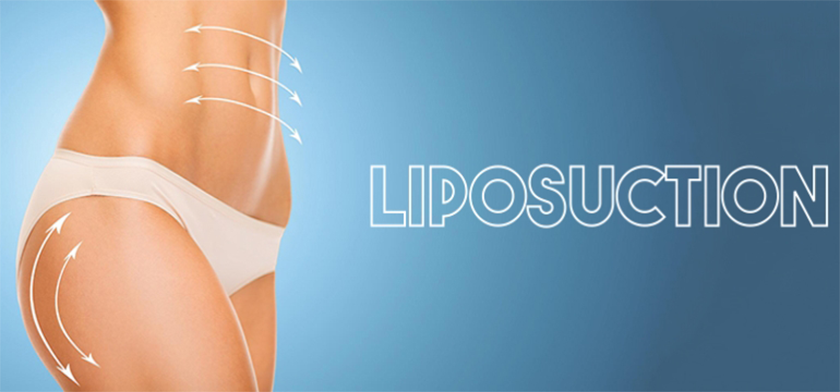 Liposuction