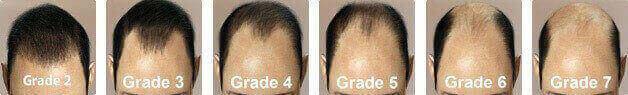 Solace_Hair_Grade